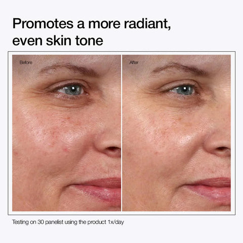 Clarifying 7% Glycolic Acid Toner – Exfoliates, Brightens & Smooths Skin for a Radiant Glow 🌿
